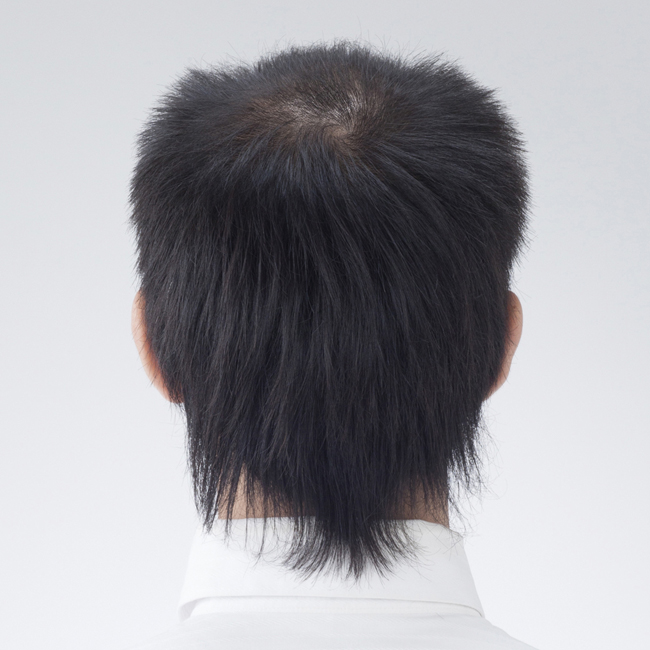 ヘアスタイル before・after
