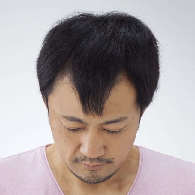 ヘアスタイル before・after