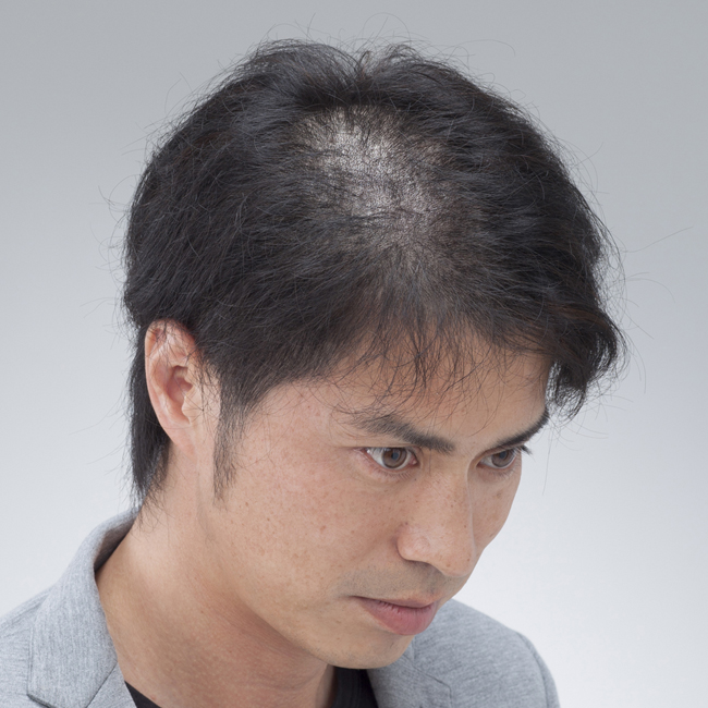 ヘアスタイル before・after